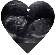 Load image into Gallery viewer, Keepsake baby scan heart